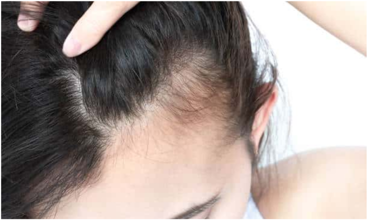 Perte de cheveux
Mésothérapie et microneedling stimulent la repousse, freinent la chute et densifient les cheveux naturellement.
En savoir plus