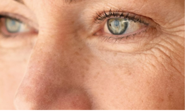 Wrinkles and Fine Lines

Venus Versa™ Pro smooths wrinkles, firms the skin, and stimulates collagen—without invasive surgery.

    Learn More