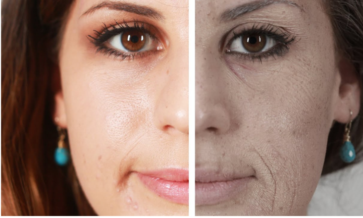 Dull Complexion

A dull complexion lacks radiance and may appear tired or lifeless, often caused by stress, aging, or dehydration.

   Learn More