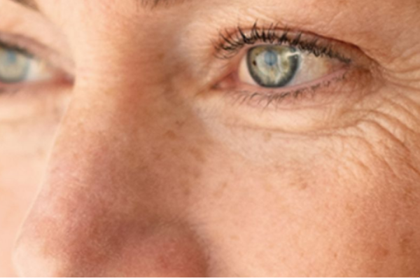 Rides et ridules
Venus Versa™ Pro lisse rides, raffermit la peau et stimule le collagène sans chirurgie invasive.
En savoir plus